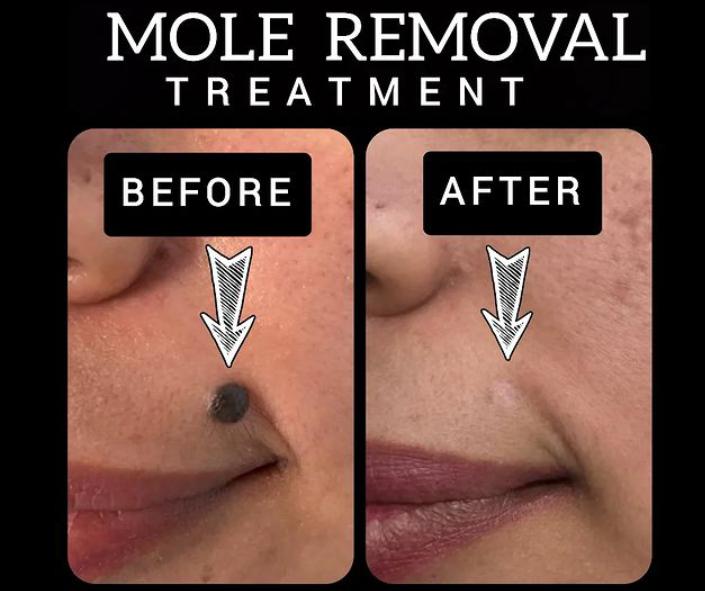 💉Anagha Aesthetics and Hair Transplant 