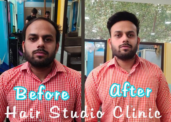 best hair extension salons del