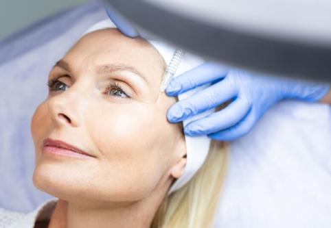 dermal fillers and collagen st