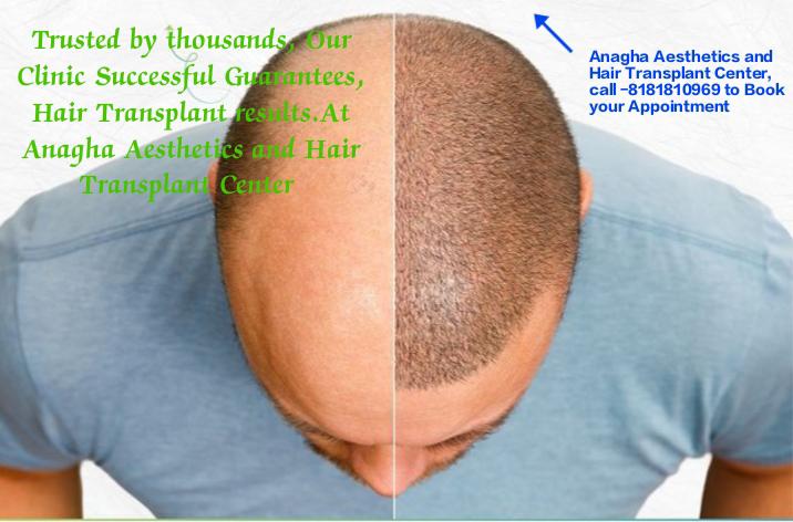     Anagha Aesthetics and Hair Transplan