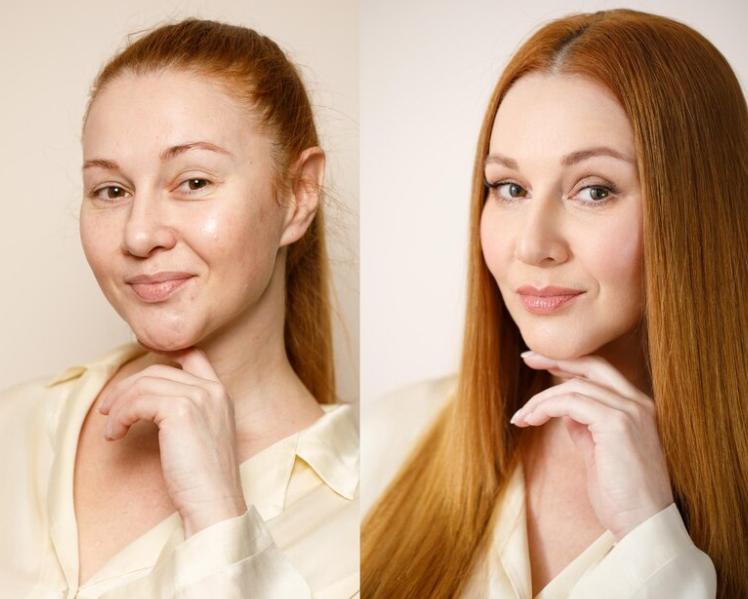 natural looking facelift exper
