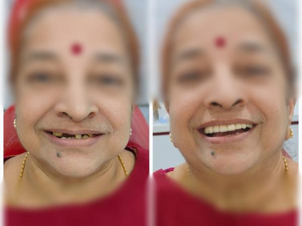 update image