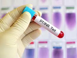 illness hmpv test