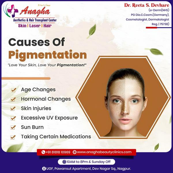 Best treatment on pigmentation in Anagha