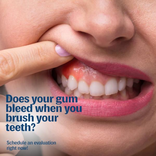 gum disease prevention