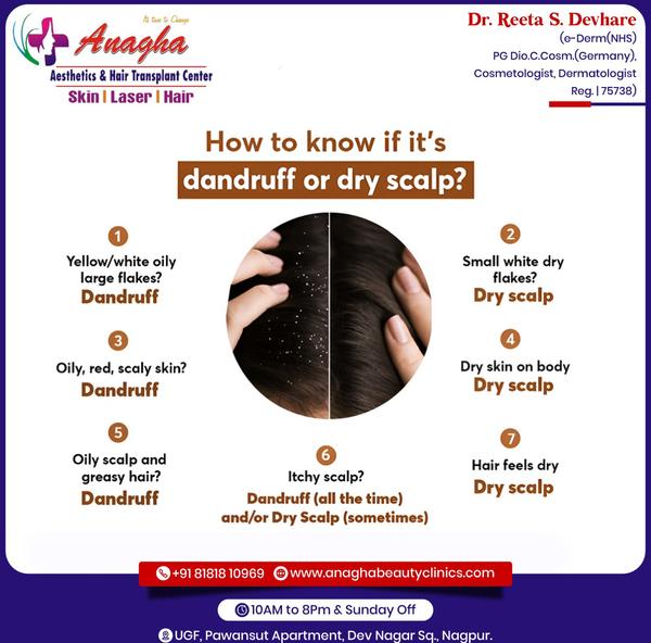 Itchy scalp?, Dandruff (all the time), a