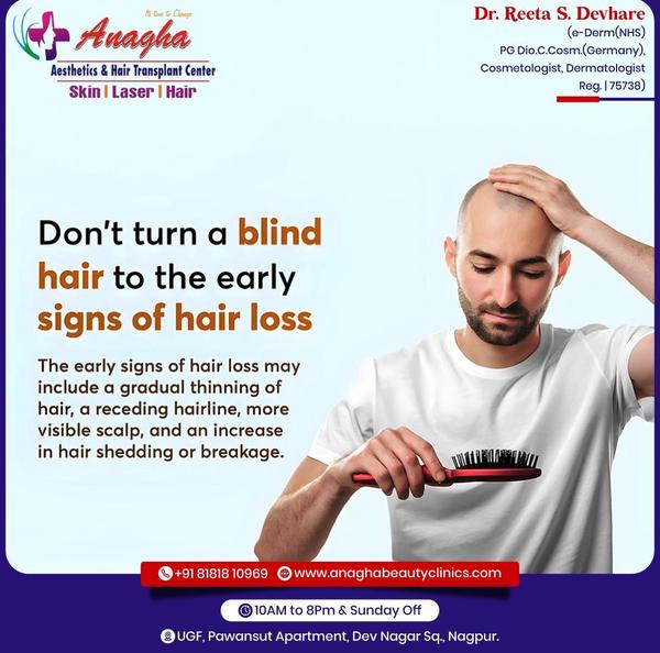 Freedom from baldness consult with our E