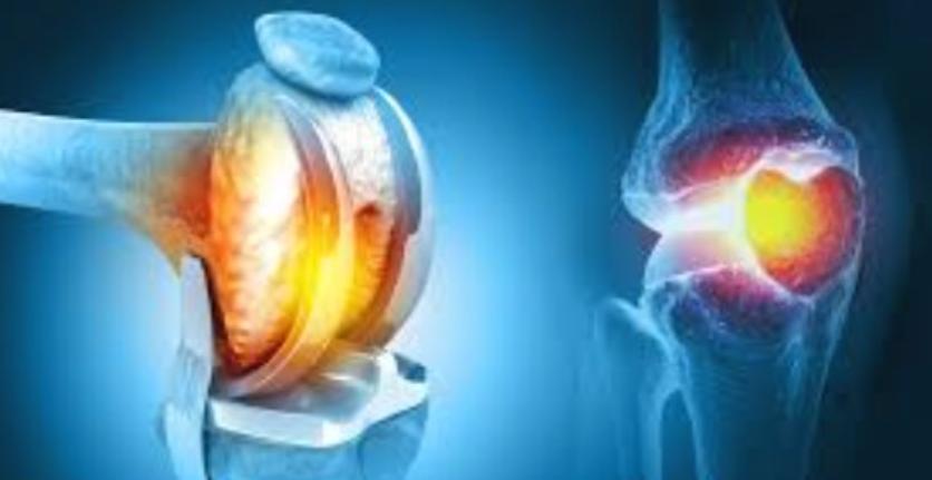 damaged joint surfaces