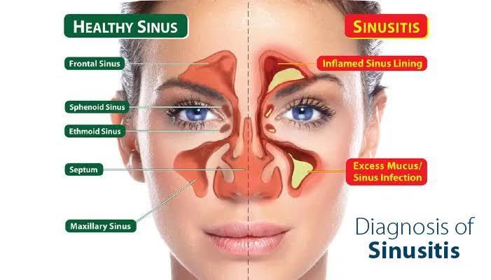 effective allergy and sinus tr
