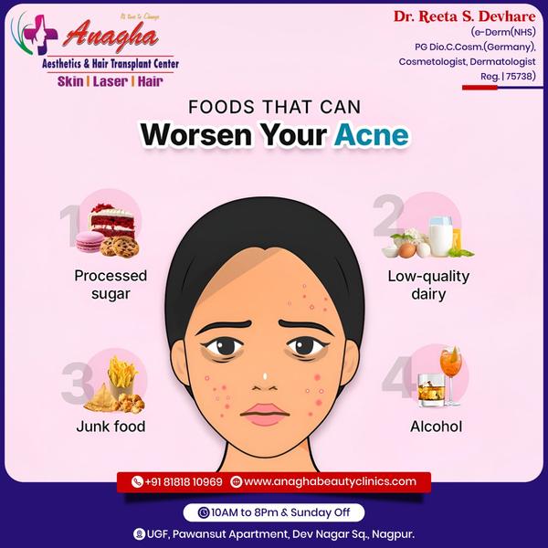 Best Acne treatment in Anagha Aesthetics