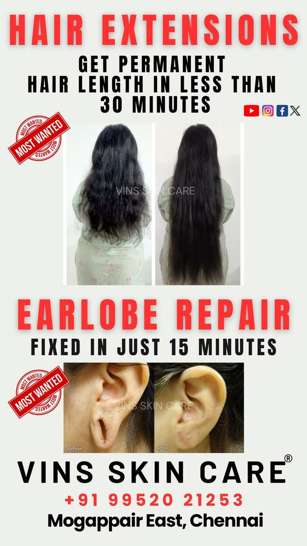 Hair Extension & Earlobe Repair Treatmen