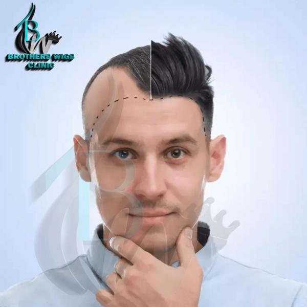 all day comfort cancer wigs de