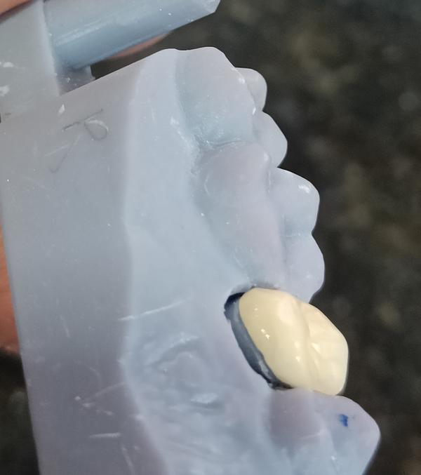 do not wait too long to treat your denta