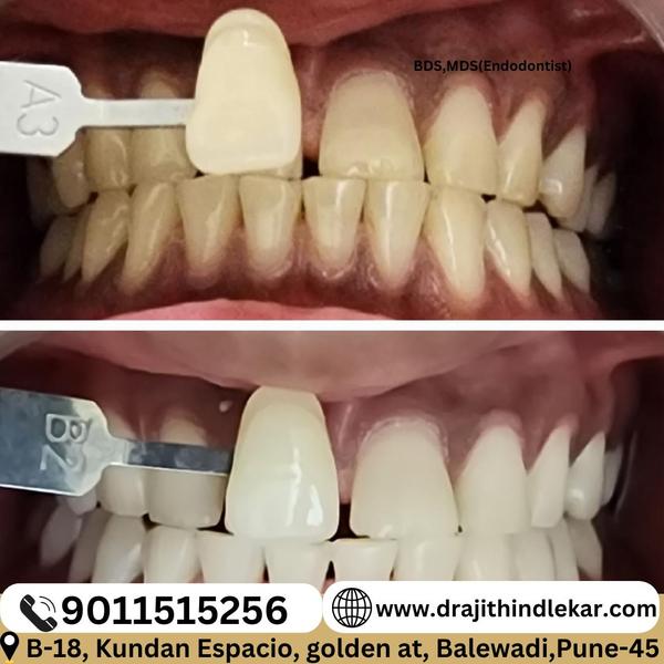 update image