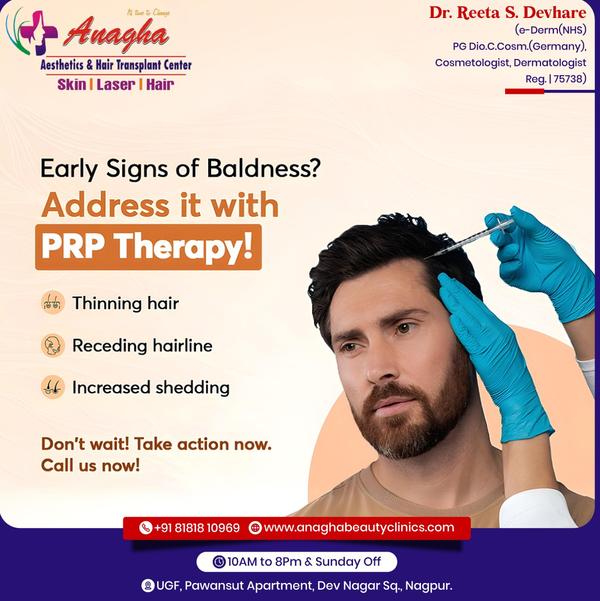 Best PRP therapy in Anagha Aesthetics an
