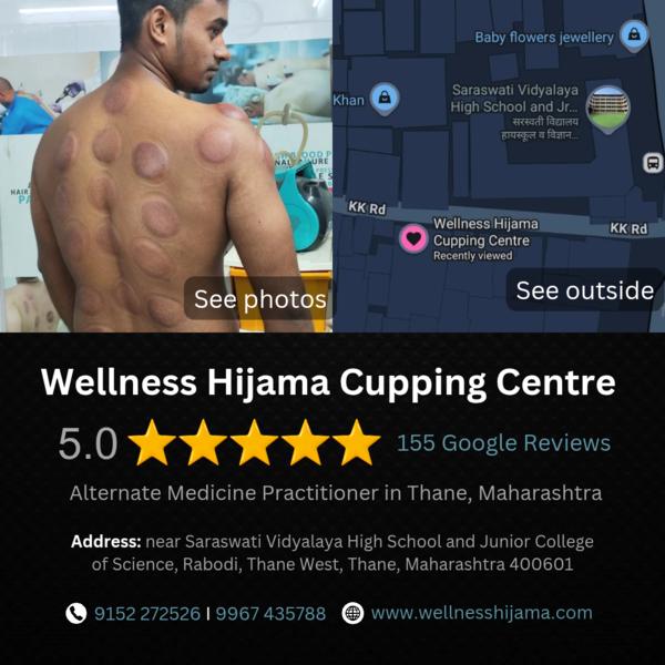 Best Hijama Cupping Centre in Thane. Con