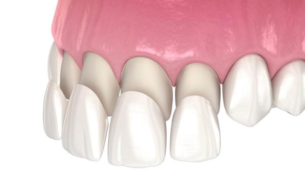 painless procedure