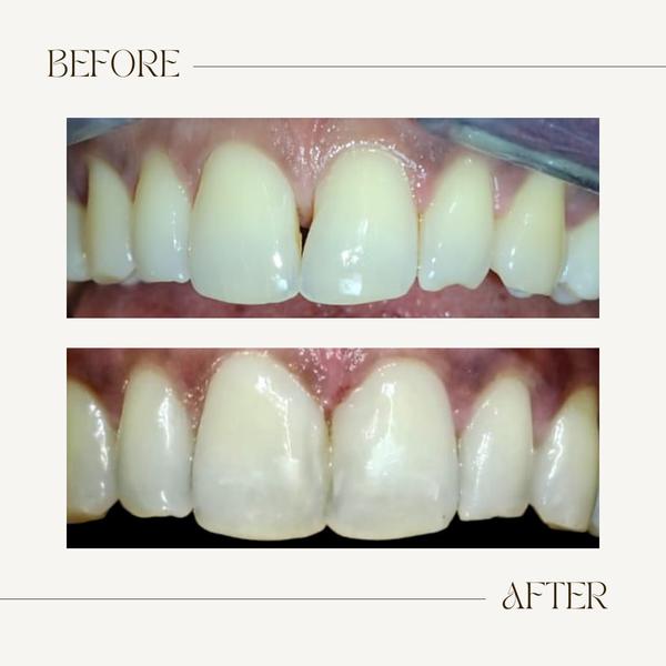 update image