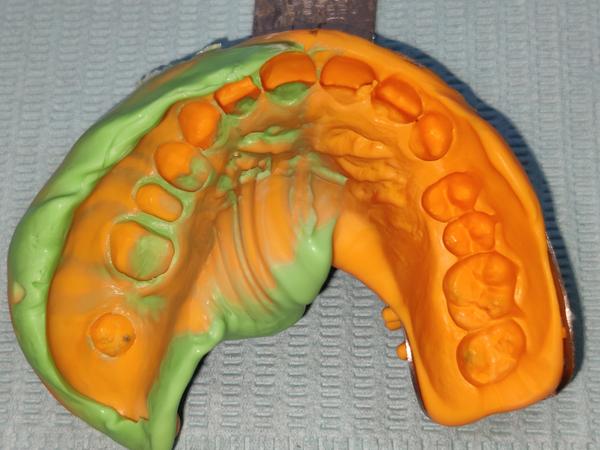 #dentistnearme #bestimplantolo