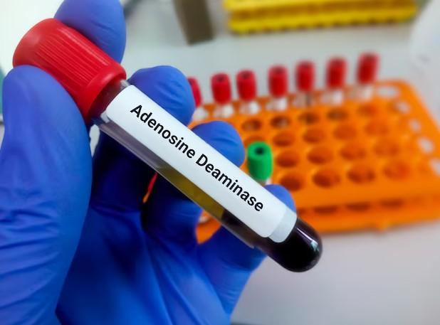 ada enzyme