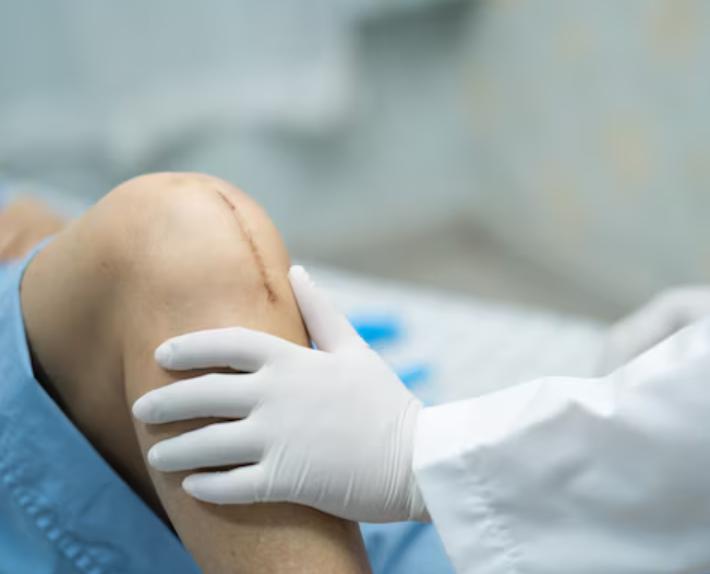 knee pain relief jaipur surger