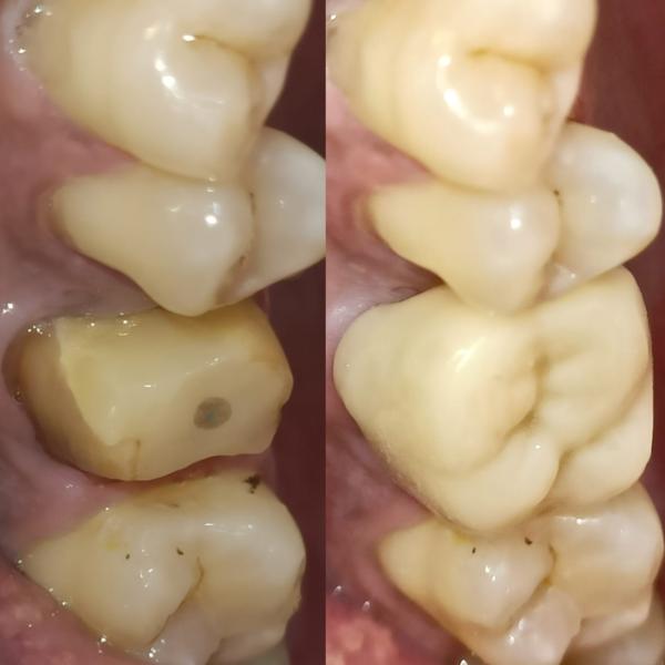 update image