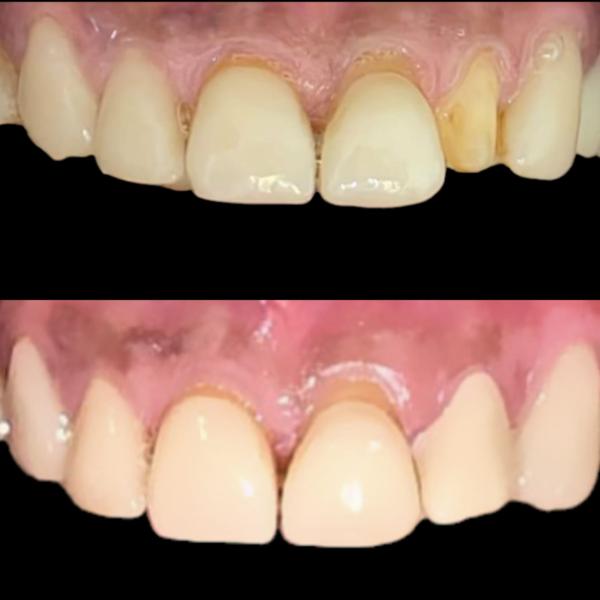 update image