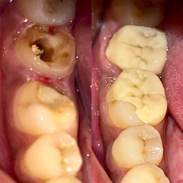 update image