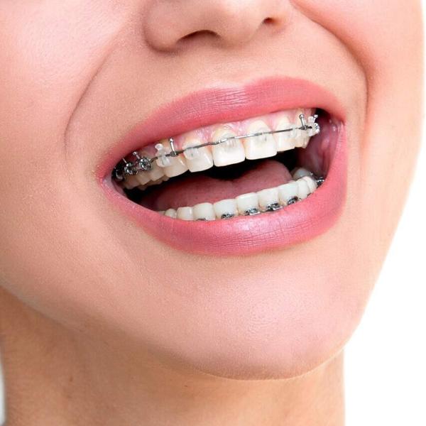 smile add