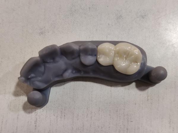 #dentistnearme #bestimplantolo