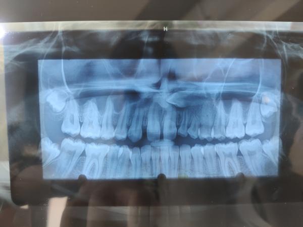 Best dentist in Dhankawadi <br