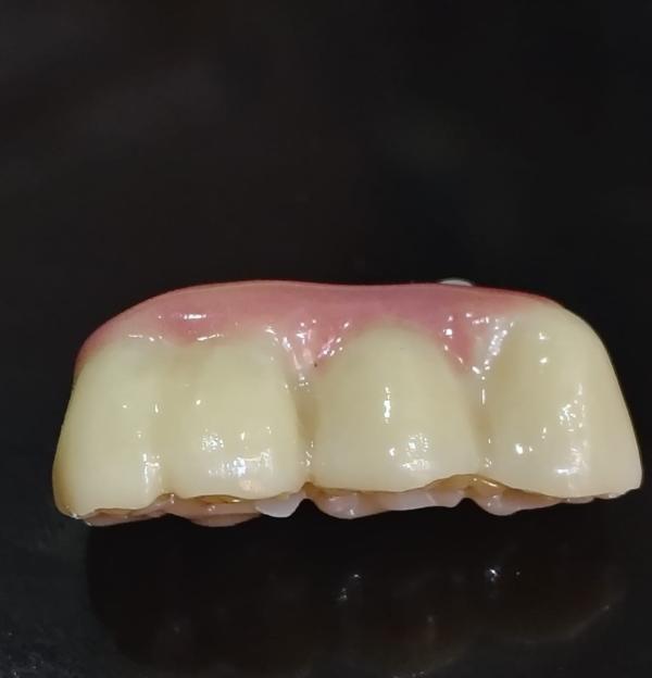 update image
