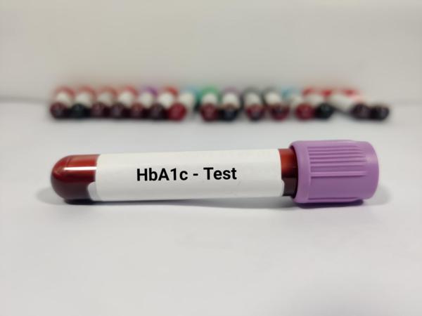 diabetes care