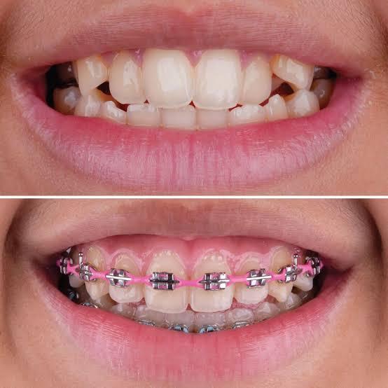 stressfree environment