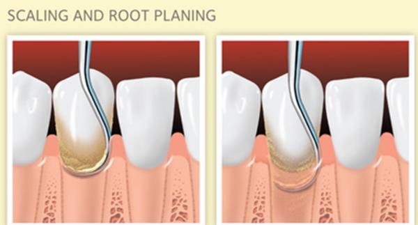 best dental clinic for teeth w