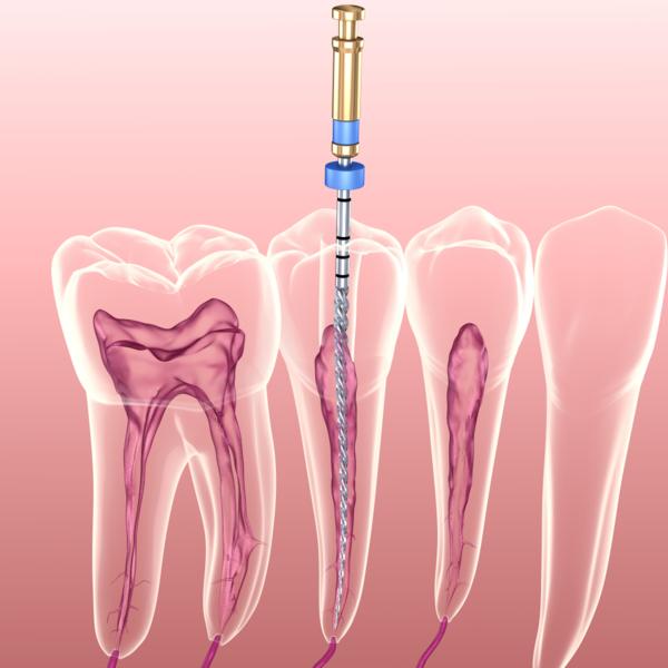 tooth structure