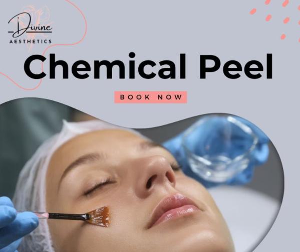 acne scar treatment options ba
