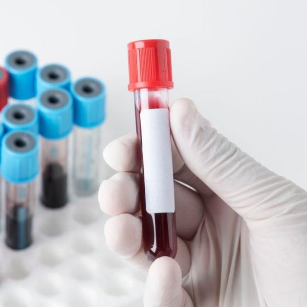 online blood test booking west
