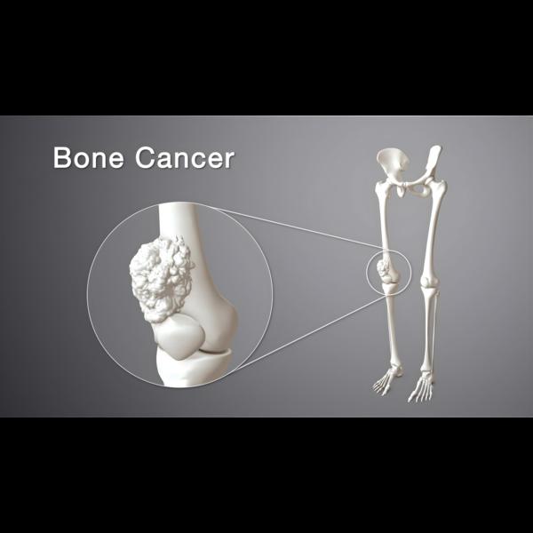 update image