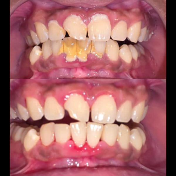 update image