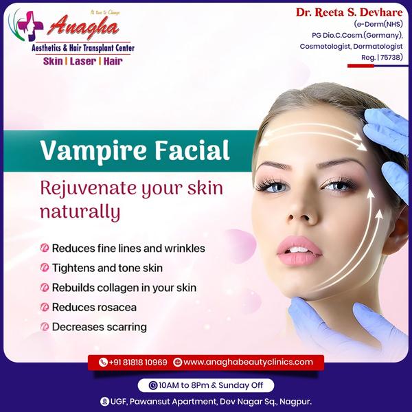 Best vampire facial treatment in Anagha 