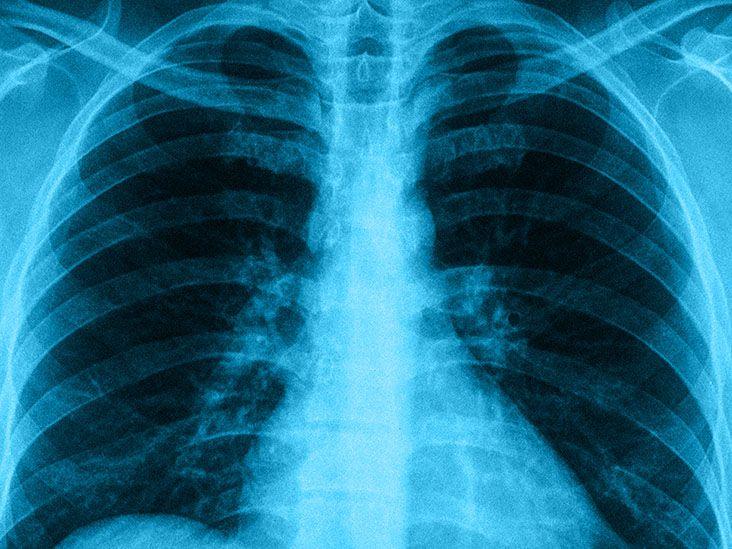 radicare portable x ray and ec