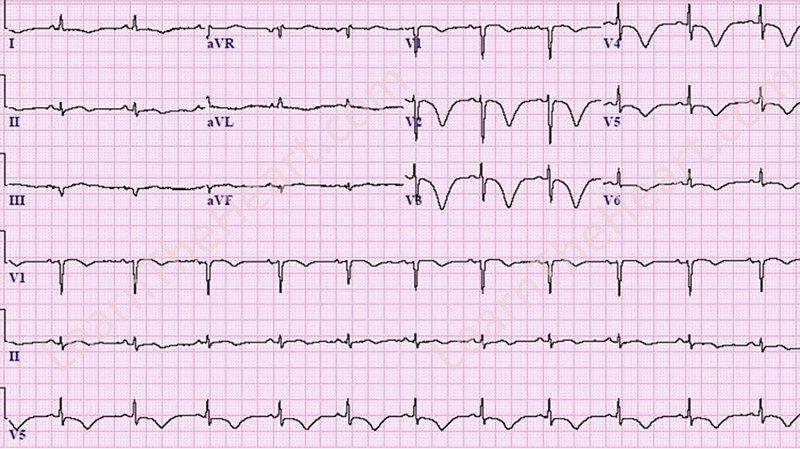radicare portable x ray servic