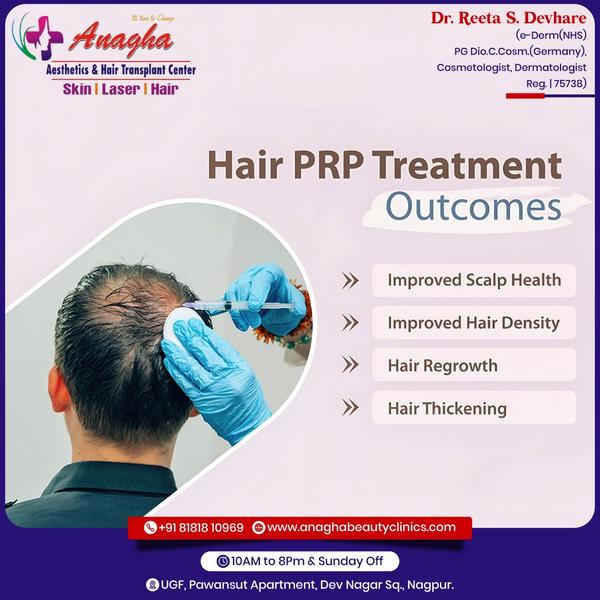Best PRP treatment in Anagha Aesthetics 