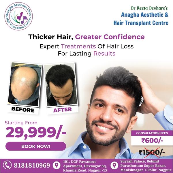 Best treatment Gives you on Hair Loss pr