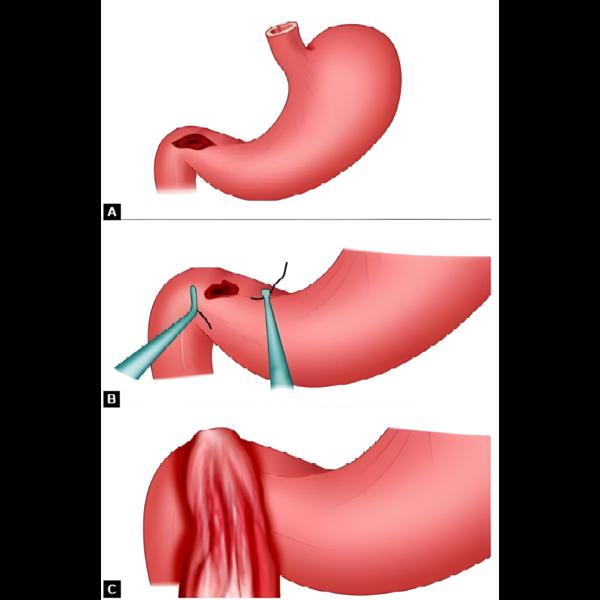 update image