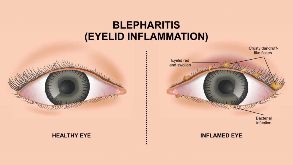 salem professional eyecare ser