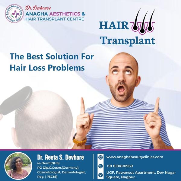 Best Hair Transplant Treatment In Anagha