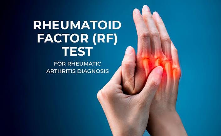 rheumatoid factor test