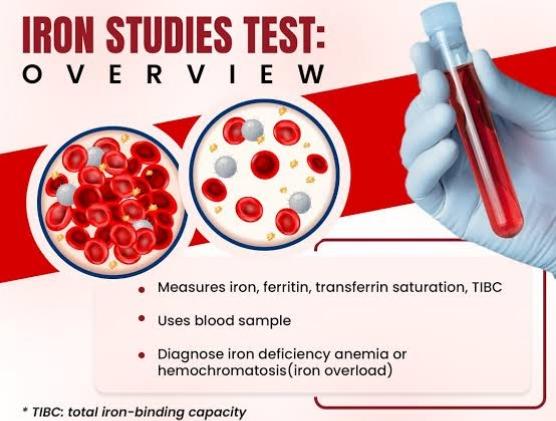 iron tests measure